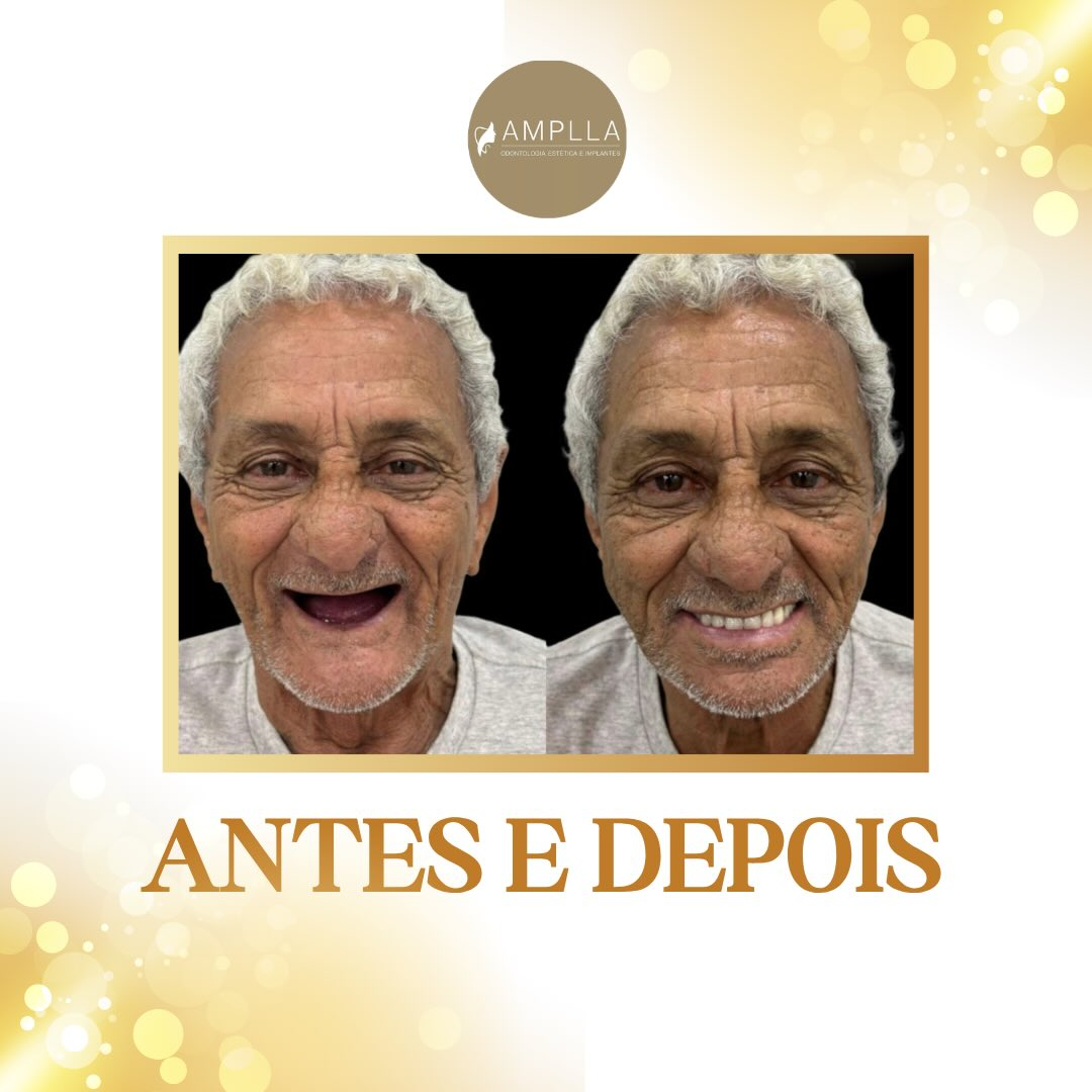 Antes e depois — caso 3 · Amplla Odontologia